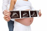 Couple Expecting Child with X-Ray stock photo